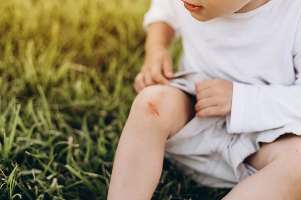 Niedobory witamin a problemy z gojeniem się ran.Skutki niedoboru witaminy C